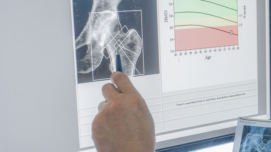 Bone Mineral Density (BMD)