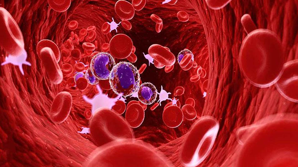 Hematology / Blood Diseases Treatment